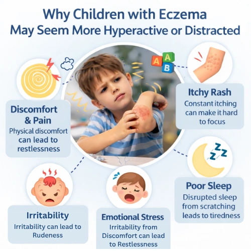 Children with Eczema May Seem More Hyperactive or Distracted
