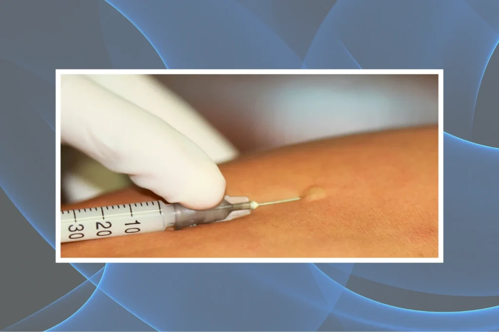 Medical injection used during a supervised drug allergy assessment