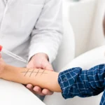 A doctor using a dropper to apply an allergen liquid extract onto a child's forearm marked with a testing grid.