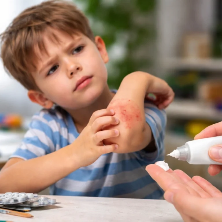 Eczema & ADHD: Can Steroid Creams Affect Behaviour