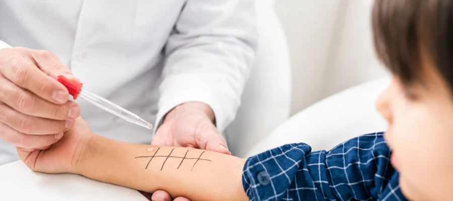 A doctor using a dropper to apply an allergen liquid extract onto a child's forearm marked with a testing grid.
