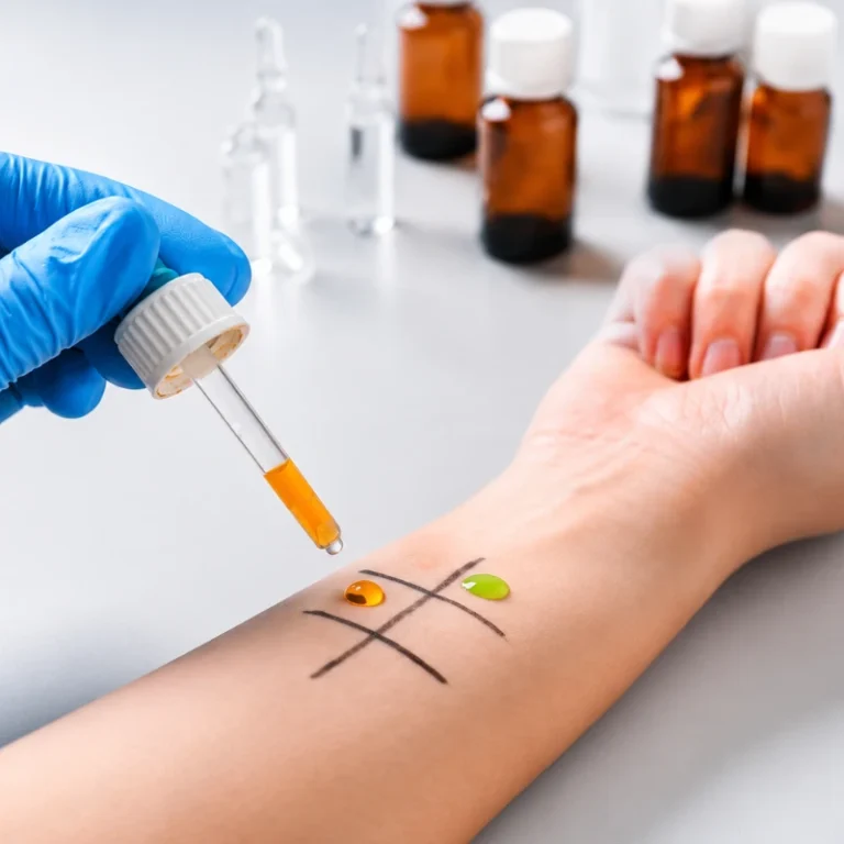 Skin testing for suspected medication allergy