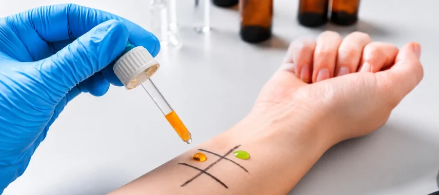 Skin testing for suspected medication allergy